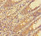 General Transcription Factor IIF Subunit 1 antibody, LS-C678151, Lifespan Biosciences, Immunohistochemistry paraffin image 