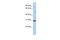 RAB26, Member RAS Oncogene Family antibody, PA5-44261, Invitrogen Antibodies, Western Blot image 