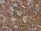 ATP Citrate Lyase antibody, PA5-29497, Invitrogen Antibodies, Immunohistochemistry paraffin image 