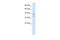 CCAAT Enhancer Binding Protein Beta antibody, 27-319, ProSci, Western Blot image 