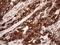 Melan-A antibody, LS-C794067, Lifespan Biosciences, Immunohistochemistry paraffin image 