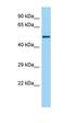 Lysine Acetyltransferase 8 antibody, orb330578, Biorbyt, Western Blot image 