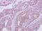 ATPase H+ Transporting V1 Subunit E1 antibody, PA5-29899, Invitrogen Antibodies, Immunohistochemistry paraffin image 