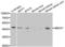 Gamma-Butyrobetaine Hydroxylase 1 antibody, LS-C334306, Lifespan Biosciences, Western Blot image 