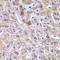 Golgi Membrane Protein 1 antibody, LS-C747680, Lifespan Biosciences, Immunohistochemistry paraffin image 