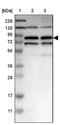 Myotubularin Related Protein 1 antibody, NBP1-86042, Novus Biologicals, Western Blot image 