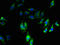 CD11A antibody, LS-C211746, Lifespan Biosciences, Immunofluorescence image 