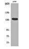 Adhesion G Protein-Coupled Receptor G6 antibody, orb160814, Biorbyt, Western Blot image 