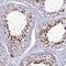 Zinc Finger MIZ-Type Containing 1 antibody, NBP1-92610, Novus Biologicals, Immunohistochemistry frozen image 