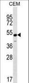 Potassium Voltage-Gated Channel Subfamily J Member 8 antibody, LS-C165436, Lifespan Biosciences, Western Blot image 