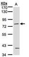 Protein Kinase C Gamma antibody, GTX102539, GeneTex, Western Blot image 