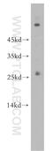 RAB5B, Member RAS Oncogene Family antibody, 17605-1-AP, Proteintech Group, Western Blot image 