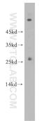 Ras-related protein Rab-5B antibody, 17605-1-AP, Proteintech Group, Western Blot image 