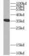 Voltage Dependent Anion Channel 1 antibody, FNab09826, FineTest, Western Blot image 