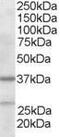 Actin Related Protein 2/3 Complex Subunit 1B antibody, PA5-18047, Invitrogen Antibodies, Western Blot image 