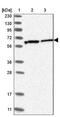 Ribophorin II antibody, NBP1-80835, Novus Biologicals, Western Blot image 