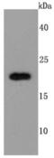 TIMP Metallopeptidase Inhibitor 2 antibody, NBP2-67204, Novus Biologicals, Western Blot image 