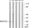 NADH:Ubiquinone Oxidoreductase Core Subunit V2 antibody, LS-B9848, Lifespan Biosciences, Western Blot image 