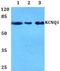 Potassium Voltage-Gated Channel Subfamily Q Member 1 antibody, A00310, Boster Biological Technology, Western Blot image 