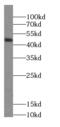 Casein Kinase 1 Delta antibody, FNab01279, FineTest, Western Blot image 