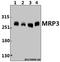 ATP Binding Cassette Subfamily C Member 3 antibody, A02429, Boster Biological Technology, Western Blot image 