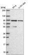 Phosphoinositide-3-Kinase Regulatory Subunit 2 antibody, NBP2-56360, Novus Biologicals, Western Blot image 