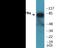 Platelet Derived Growth Factor Receptor Alpha antibody, EKC2106, Boster Biological Technology, Western Blot image 
