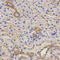 TNF Receptor Superfamily Member 1B antibody, LS-C331260, Lifespan Biosciences, Immunohistochemistry paraffin image 