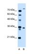 TMEM231 antibody, orb325201, Biorbyt, Western Blot image 