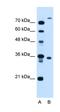 Transmembrane Protein 231 antibody, orb325201, Biorbyt, Western Blot image 