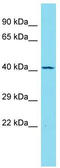 Transmembrane Protein Adipocyte Associated 1 antibody, TA334080, Origene, Western Blot image 