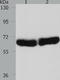Cytochrome P450 Family 1 Subfamily B Member 1 antibody, TA321056, Origene, Western Blot image 