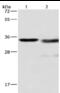 Cathepsin L antibody, MBS2517363, MyBioSource, Western Blot image 