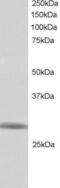 Ring Finger Protein 141 antibody, PA5-18162, Invitrogen Antibodies, Western Blot image 