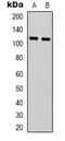 NLR Family Pyrin Domain Containing 3 antibody, LS-C368954, Lifespan Biosciences, Western Blot image 