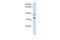 Solute Carrier Family 25 Member 34 antibody, GTX46751, GeneTex, Western Blot image 