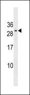 Ring Finger Protein 223 antibody, 60-442, ProSci, Western Blot image 