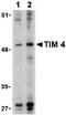T Cell Immunoglobulin And Mucin Domain Containing 4 antibody, ab47637, Abcam, Western Blot image 