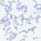 Interleukin 1 Beta antibody, LS-C746953, Lifespan Biosciences, Immunohistochemistry paraffin image 