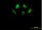 WD40 repeat-containing protein SMU1 antibody, H00055234-B01P, Novus Biologicals, Immunocytochemistry image 