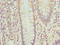 Oligophrenin 1 antibody, LS-C676211, Lifespan Biosciences, Immunohistochemistry paraffin image 