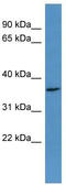 Olfactory Receptor Family 2 Subfamily H Member 2 antibody, TA342712, Origene, Western Blot image 