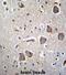 NRN1L antibody, abx027102, Abbexa, Immunohistochemistry paraffin image 