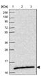 SEC61 Translocon Beta Subunit antibody, NBP2-13290, Novus Biologicals, Western Blot image 