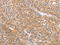 CD2 Associated Protein antibody, CSB-PA126362, Cusabio, Immunohistochemistry paraffin image 