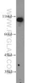 Ornithine Decarboxylase 1 antibody, 23454-1-AP, Proteintech Group, Western Blot image 