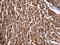 Karyopherin Subunit Beta 1 antibody, LS-C796063, Lifespan Biosciences, Immunohistochemistry paraffin image 