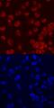 Forkhead box protein C2 antibody, MAB5044, R&D Systems, Immunofluorescence image 
