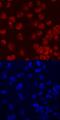 Forkhead box protein C2 antibody, MAB5044, R&D Systems, Immunofluorescence image 