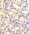 Fructosamine 3 Kinase Related Protein antibody, M12068, Boster Biological Technology, Immunohistochemistry paraffin image 
